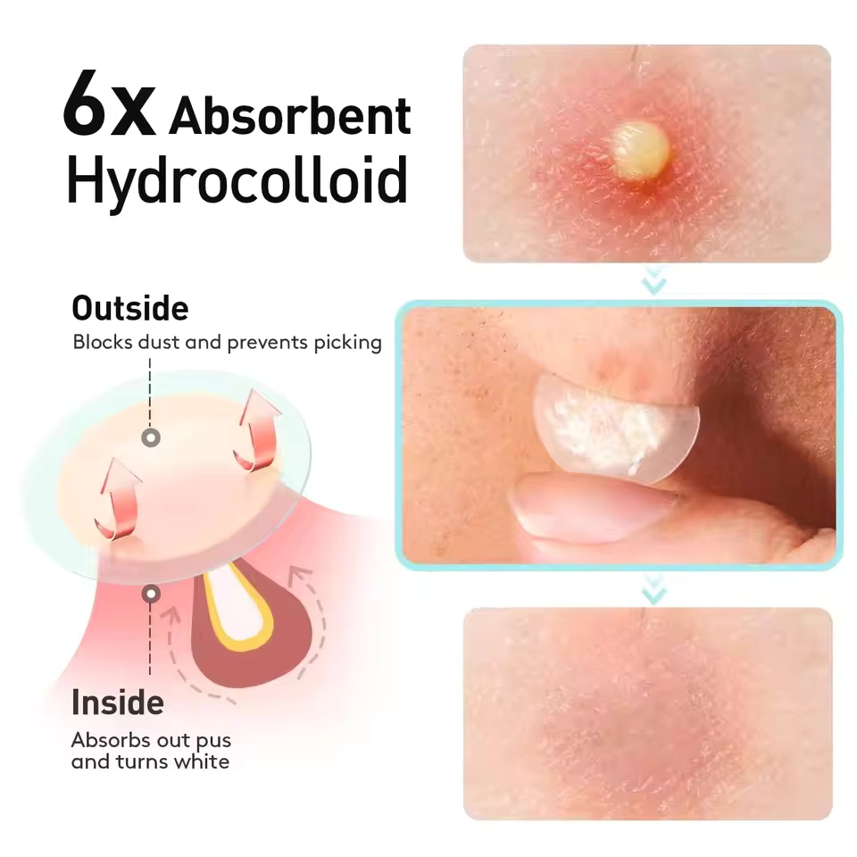 360 pezzi/scatola cerotti per  - Face Oil recensione e prezzo