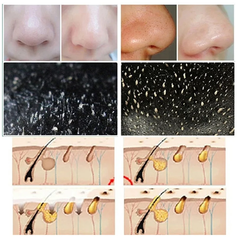 10 pz Punti Neri Naso Strisce  - Cleanser Face recensione e prezzo