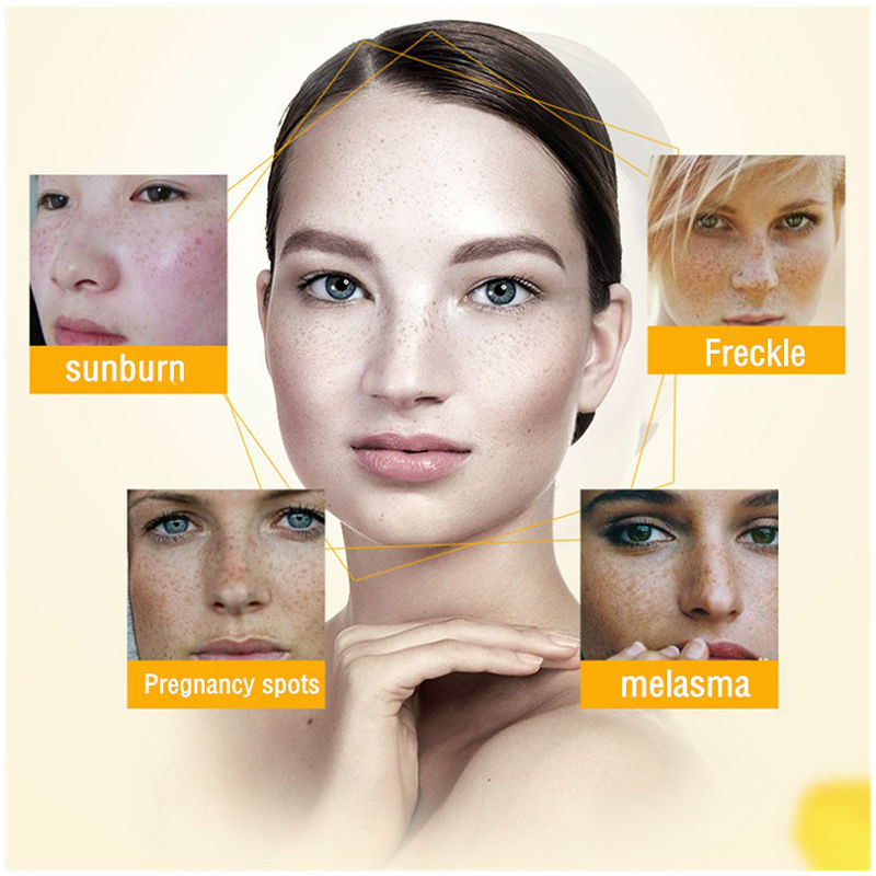 Dimollaure crema sbiancante le - Retinol Cream recensione e prezzo