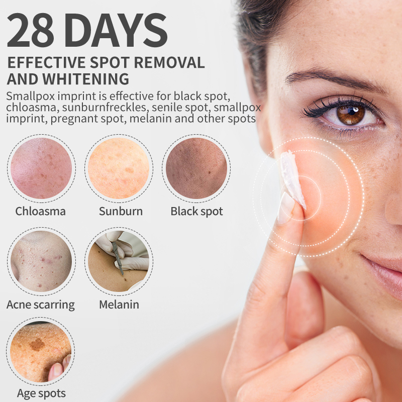 Dimollaure crema sbiancante le - Retinol Cream recensione e prezzo
