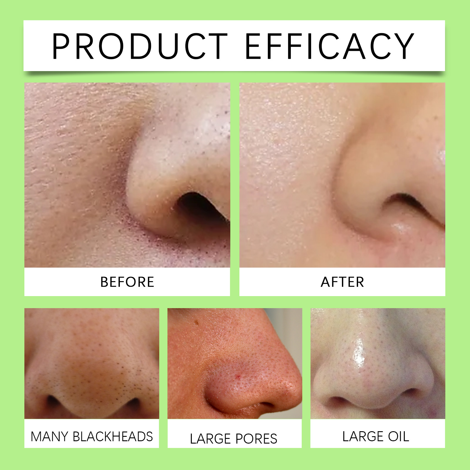 Strisce Nasali al Carbone di B - Cleanser Face recensione e prezzo